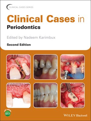 cover image of Clinical Cases in Periodontics